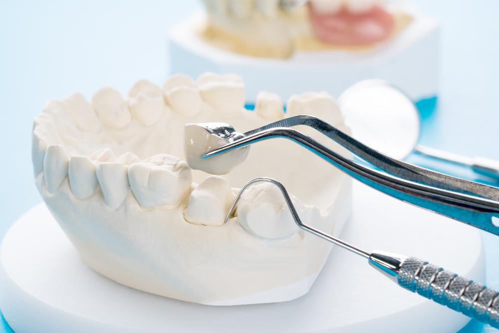 close up of dental tool and mouth mold | tooth extraction high point 
