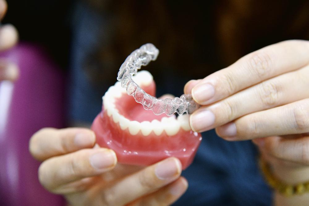 clear aligner with mouth mold | clear aligners high point nc