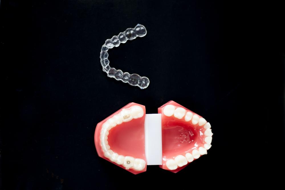 invisalign and mouth model | invisalign high point nc